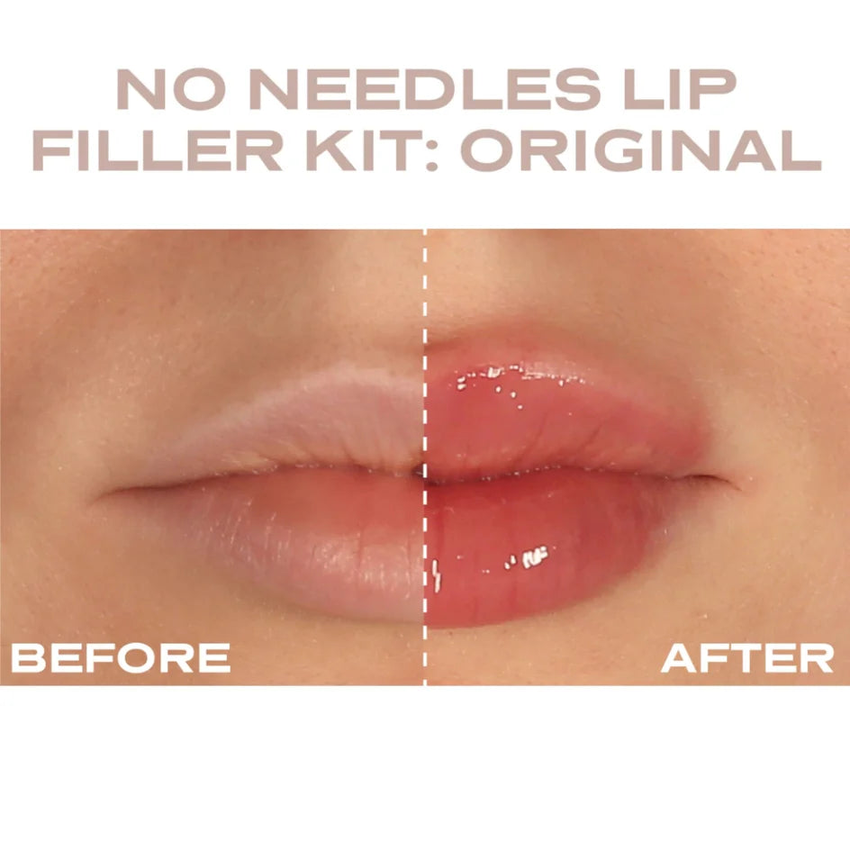 Plump It! - At Home Clinic Box