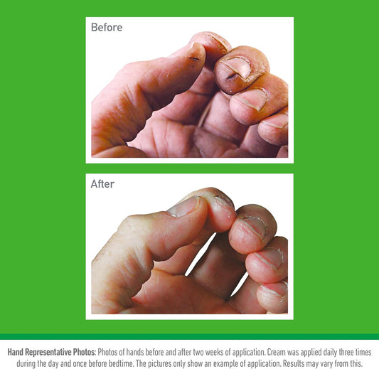How to Fix Cracked Heels (and Why O’Keeffe’s Working Hands Can Help)