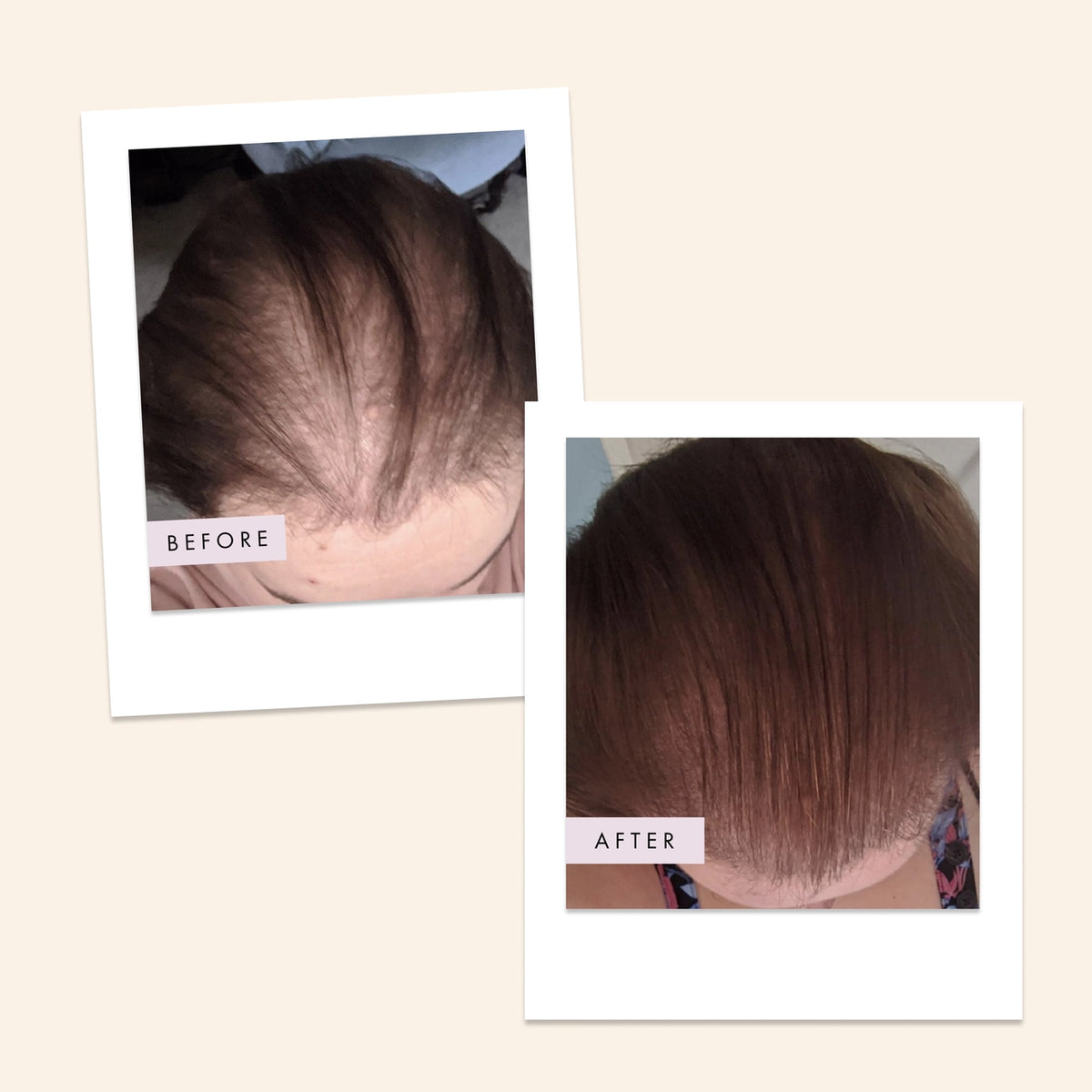 Hair Gain Capsules - 60 Capsules