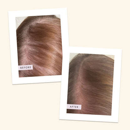 Hair Gain Scalp Foam 50ml Leave-In Treatment