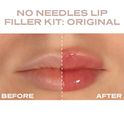 Plump It! - At Home Clinic Box